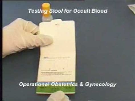 Unveiling Occult Blood in Stool: Understanding the ICD-10 Diagnosis